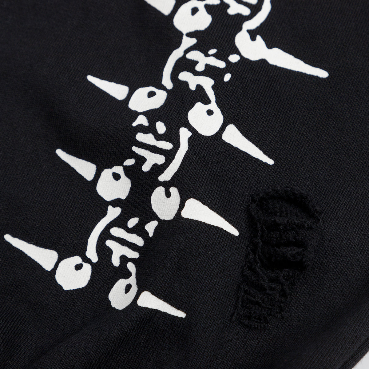 The Lobotomy Sweatpants
