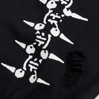The Lobotomy Sweatpants